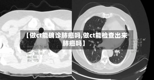 【做ct能确诊肺癌吗,做ct能检查出来肺癌吗】