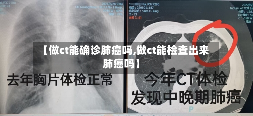 【做ct能确诊肺癌吗,做ct能检查出来肺癌吗】
