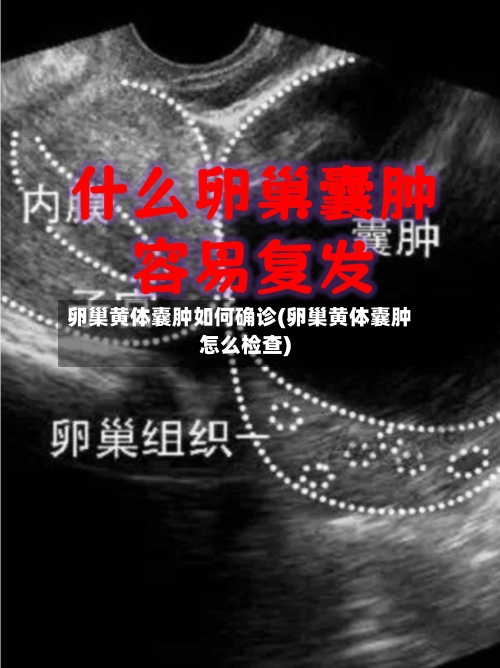 卵巢黄体囊肿如何确诊(卵巢黄体囊肿怎么检查)