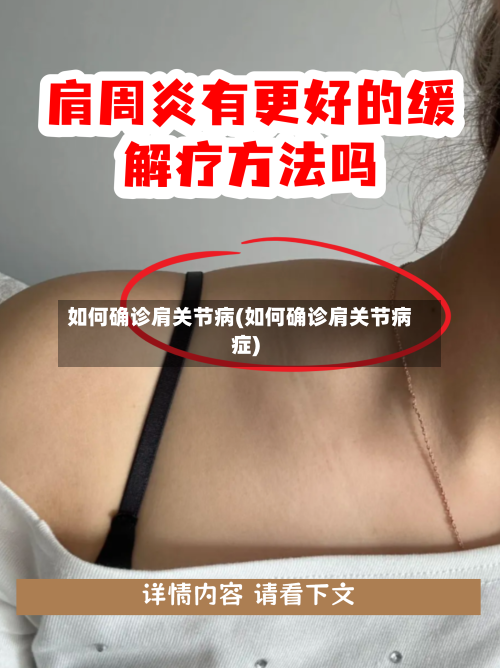 如何确诊肩关节病(如何确诊肩关节病症)