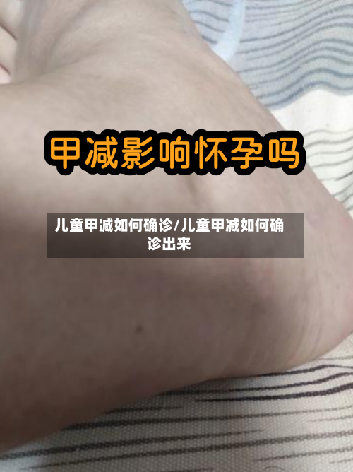 儿童甲减如何确诊/儿童甲减如何确诊出来