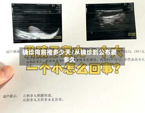 确诊向前推多少天/从确诊到公布要多久