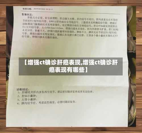【增强ct确诊肝癌表现,增强ct确诊肝癌表现有哪些】