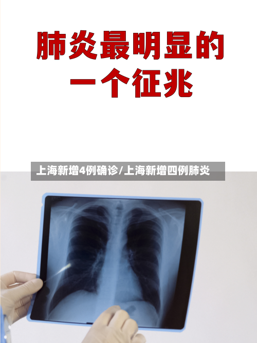 上海新增4例确诊/上海新增四例肺炎