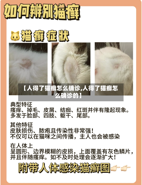 【人得了猫癣怎么确诊,人得了猫癣怎么确诊的】