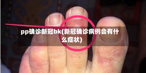 pp确诊新冠bk(新冠确诊病例会有什么症状)