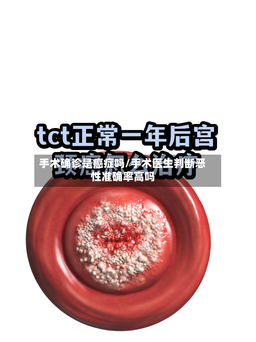 手术确诊是癌症吗/手术医生判断恶性准确率高吗