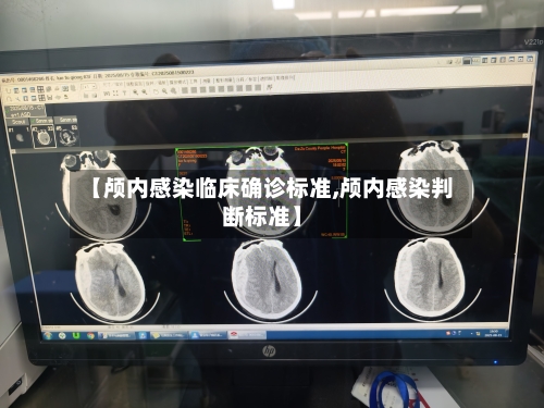 【颅内感染临床确诊标准,颅内感染判断标准】