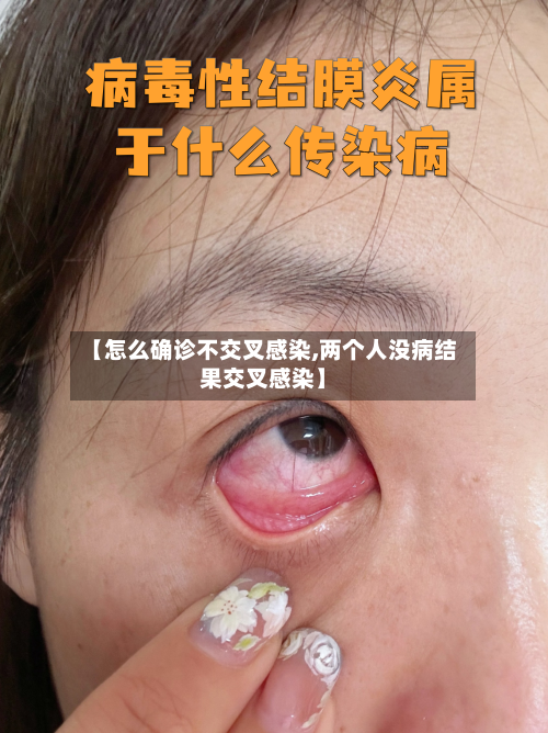 【怎么确诊不交叉感染,两个人没病结果交叉感染】