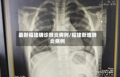 最新福建确诊肺炎病例/福建新增肺炎病例