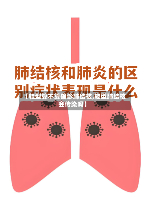 【轻型算不算确诊肺结核,轻型肺结核会传染吗】