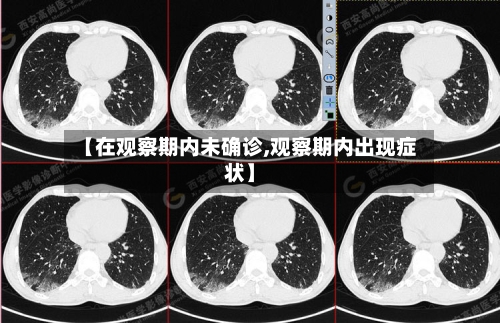 【在观察期内未确诊,观察期内出现症状】
