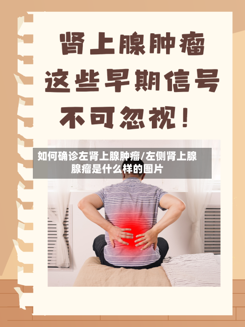 如何确诊左肾上腺肿瘤/左侧肾上腺腺瘤是什么样的图片