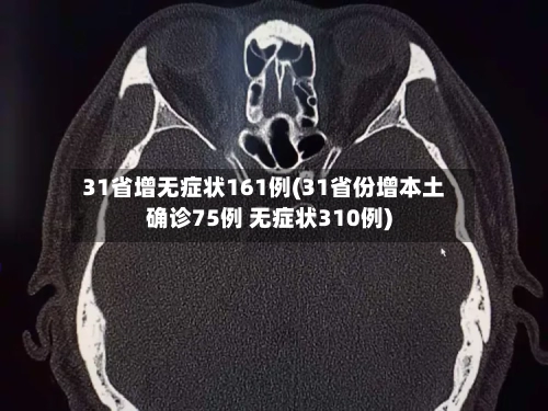 31省增无症状161例(31省份增本土确诊75例 无症状310例)