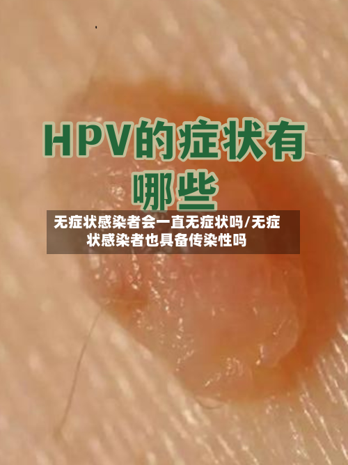 无症状感染者会一直无症状吗/无症状感染者也具备传染性吗
