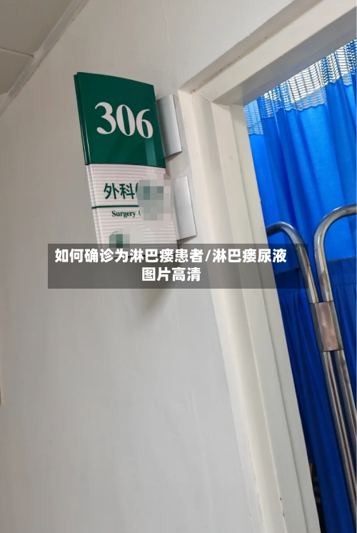 如何确诊为淋巴瘘患者/淋巴瘘尿液图片高清
