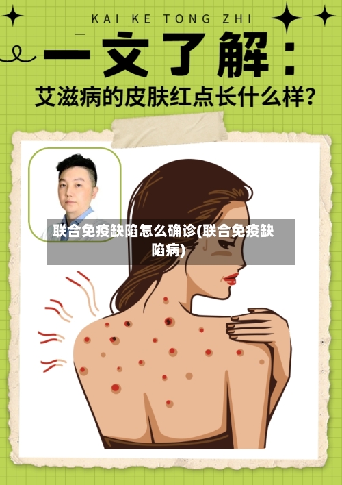 联合免疫缺陷怎么确诊(联合免疫缺陷病)