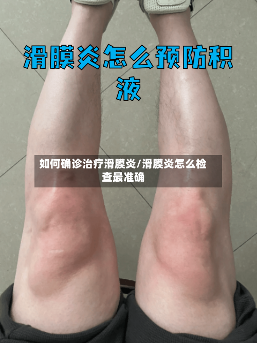 如何确诊治疗滑膜炎/滑膜炎怎么检查最准确