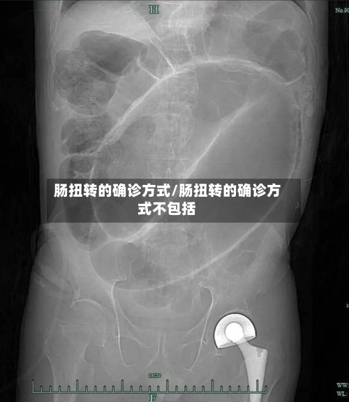 肠扭转的确诊方式/肠扭转的确诊方式不包括