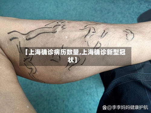 【上海确诊病历数量,上海确诊新型冠状】