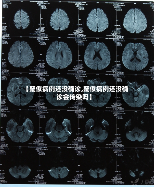 【疑似病例还没确诊,疑似病例还没确诊会传染吗】