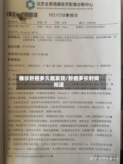 确诊肝癌多久能发现/肝癌多长时间知道