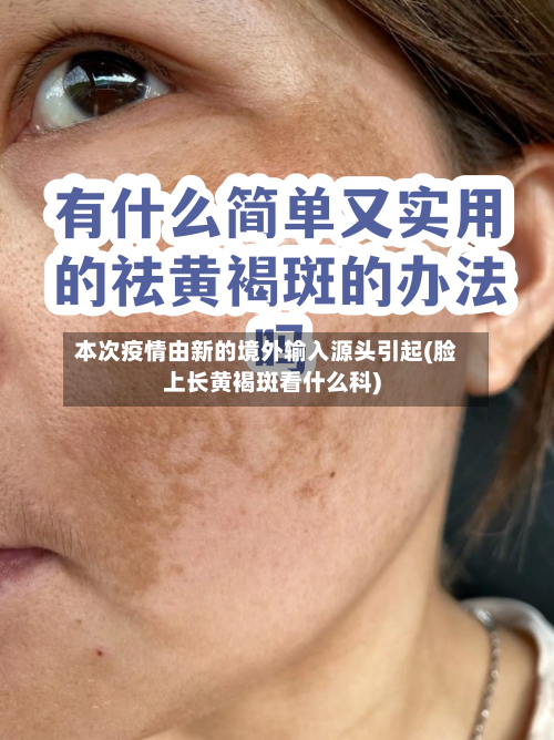 本次疫情由新的境外输入源头引起(脸上长黄褐斑看什么科)
