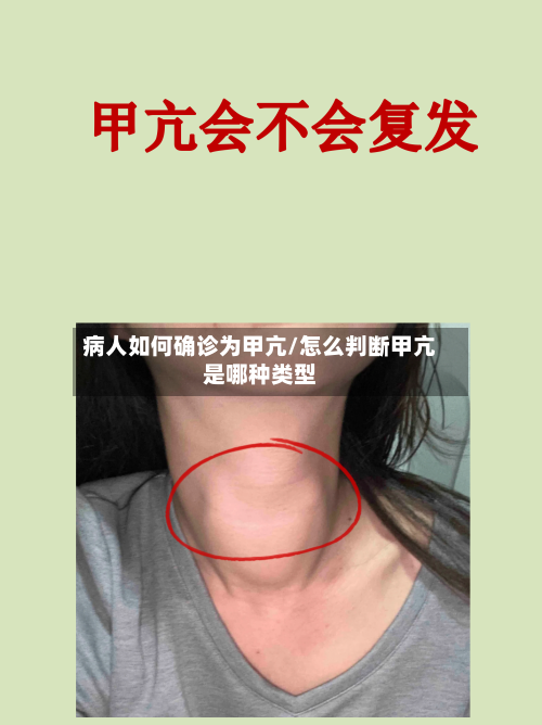 病人如何确诊为甲亢/怎么判断甲亢是哪种类型