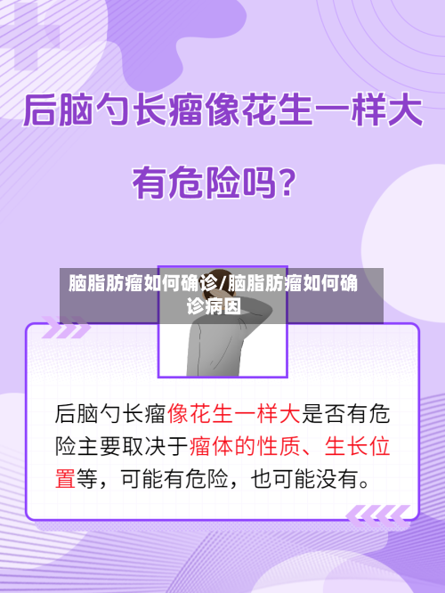 脑脂肪瘤如何确诊/脑脂肪瘤如何确诊病因