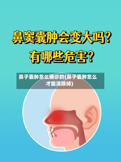 鼻子囊肿怎么确诊的(鼻子囊肿怎么才能消除掉)