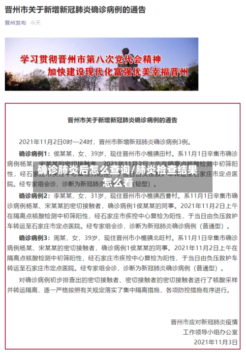 确诊肺炎后怎么查询/肺炎检查结果怎么看