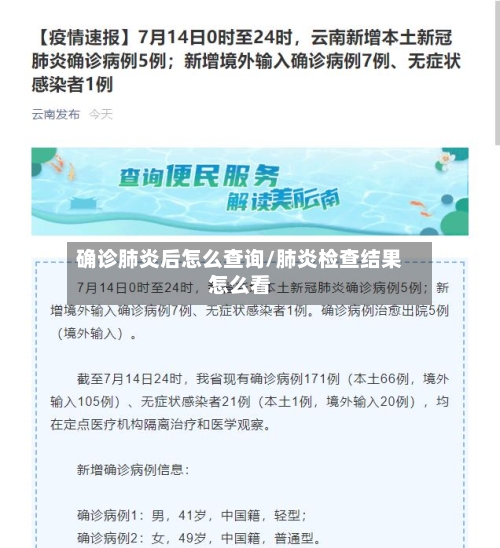 确诊肺炎后怎么查询/肺炎检查结果怎么看