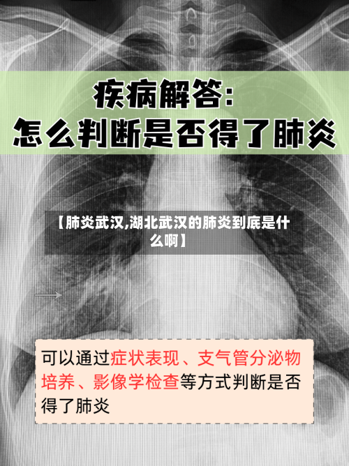 【肺炎武汉,湖北武汉的肺炎到底是什么啊】