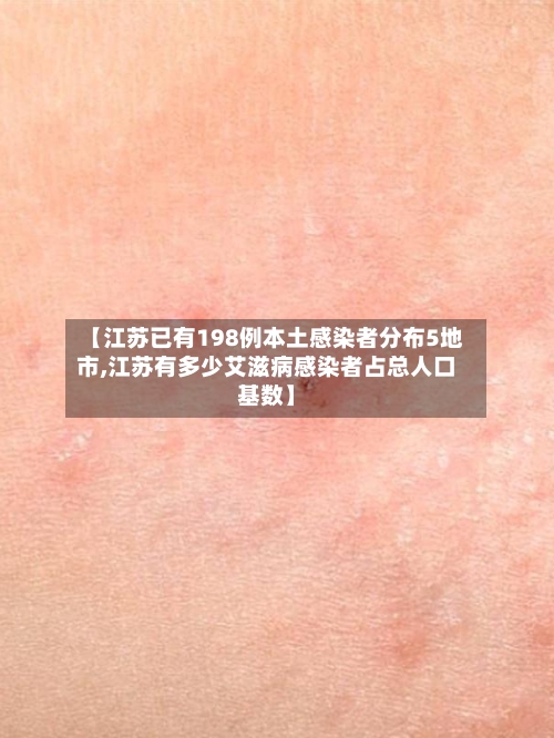 【江苏已有198例本土感染者分布5地市,江苏有多少艾滋病感染者占总人口基数】